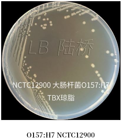 GB 4789.38－2025《食品安全國(guó)家標(biāo)準(zhǔn)　食品微生物學(xué)檢驗(yàn)　大腸埃希氏菌計(jì)數(shù)》解讀